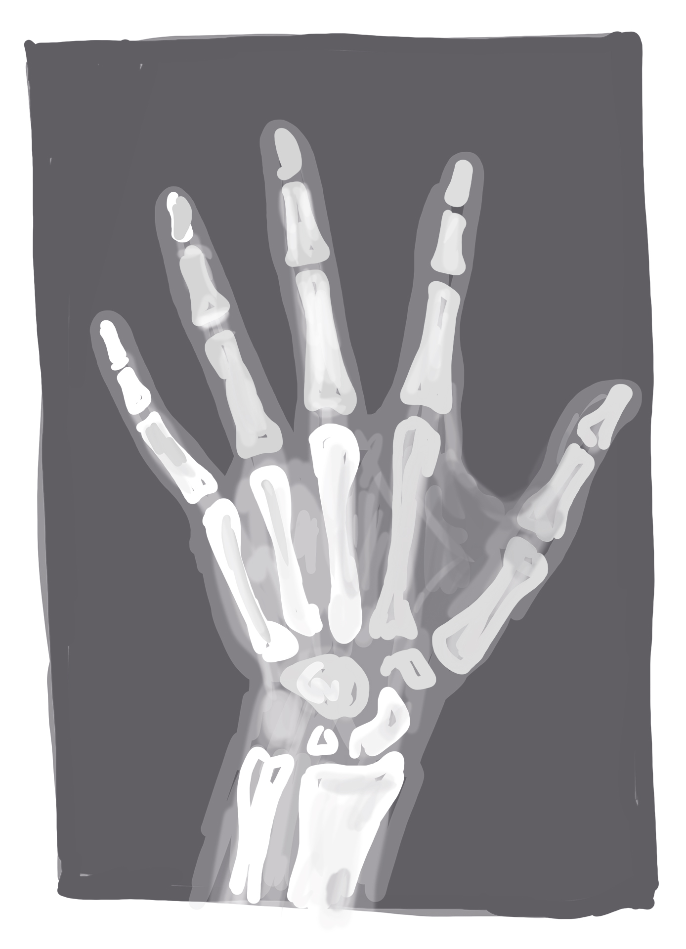 Die Röntgenaufnahme einer Hand