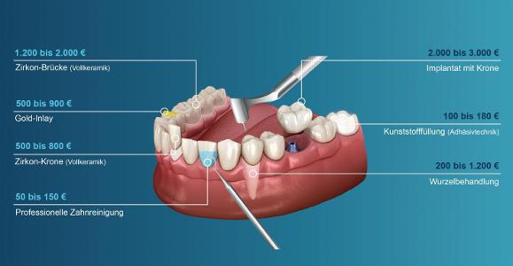 Zahnbehandlung Infografik