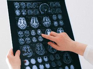 Ein Arzt schaut sich Röntgenbilder an und zeigt auf eine Stelle