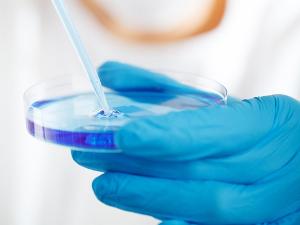 Ein Mensch mit blauem Handschuh holt mit einer Pipette Flüssigkeit aus der Petrischale