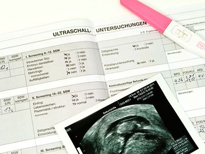  Ultraschallbild und positiver Schwangerschaftstest auf aufgeschlagenem Mutterpass